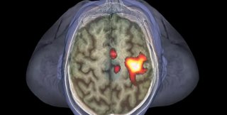 Области мозга, которые отвечают за задачу контролировать пространство вокруг человека, участвуют в активации иммунных клеток при угрозе заражения.